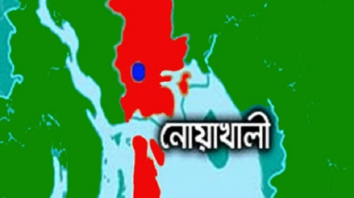 গরম মাড়ে নারীকে ঝলসে দিলেন স্বজনরা