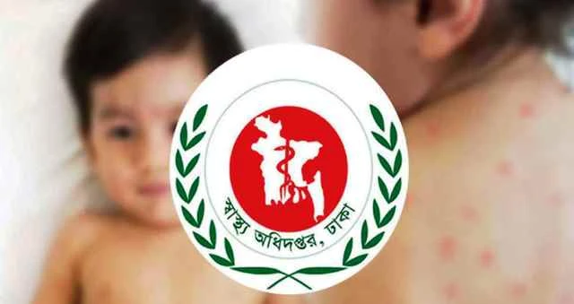 হামের উপসর্গ নিয়ে আরও ৮ শিশুর মৃত্যু